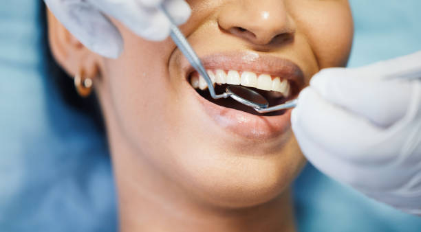 Best Knocked-Out Tooth Emergency  in Holladay, UT